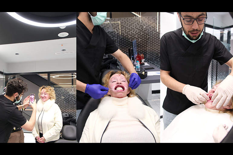 Türkiye'de Hollywood Smile